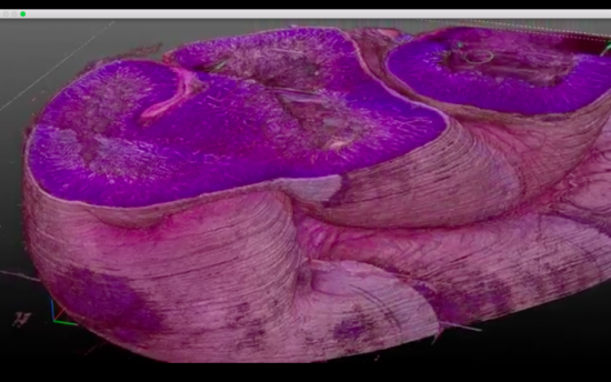 3d_tissue_map_by_3scan