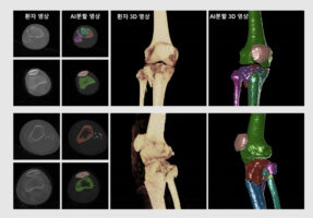 '카비랩', 딥러닝 기반 임상시험 결과 '사이언티픽 리포트' 게재